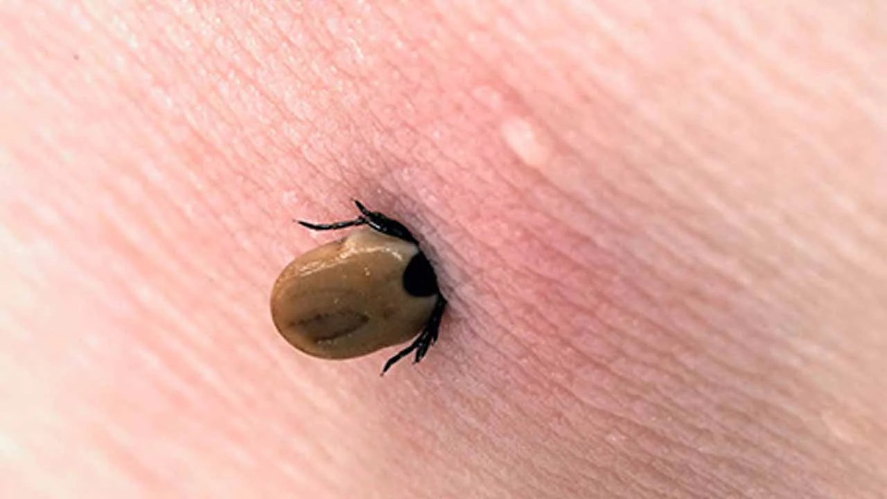 کنه